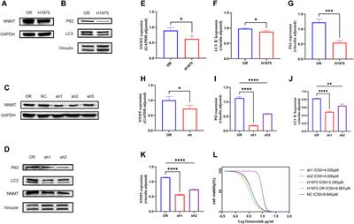 Inhibition of NNMT enhances drug sensitivity in lung cancer cells through mediation of autophagy